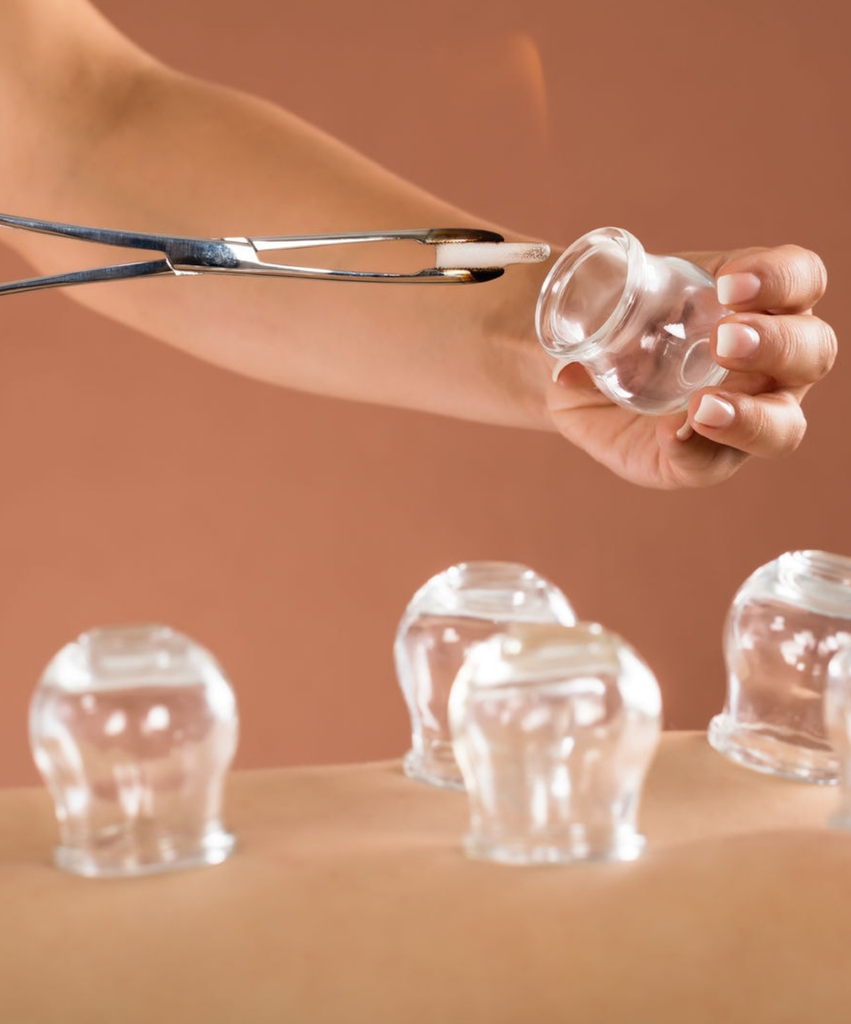 Cupping Season What does cupping do and does it really work? Ryderwear